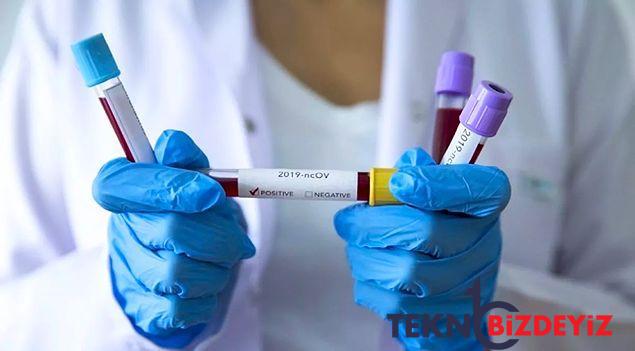 koronavirus ile ilgili korkutan aciklama gumbur gumbur geliyor 2 nV2FdZs3