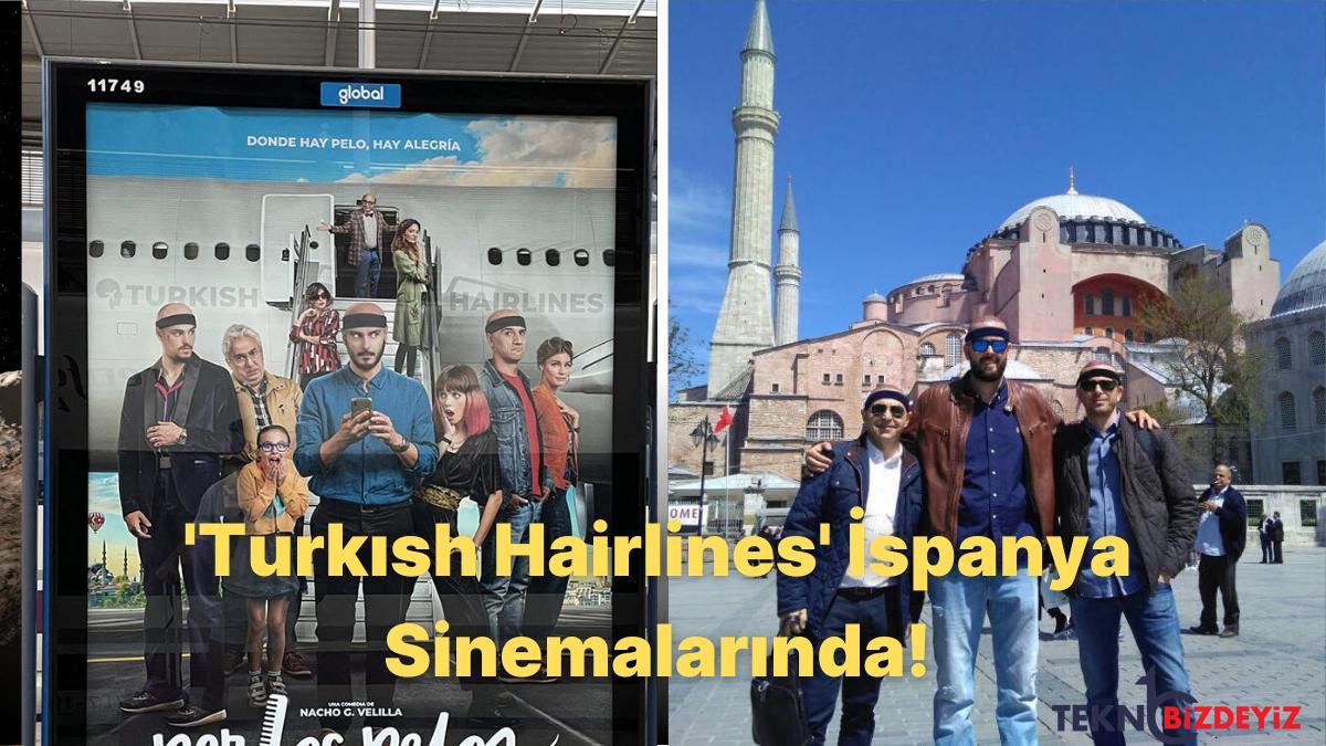 sohreti turkiyeyi asan sac ektirme tedavisi ispanya sinemasinda yer alacak turkish hairlines Uq3AhXOs