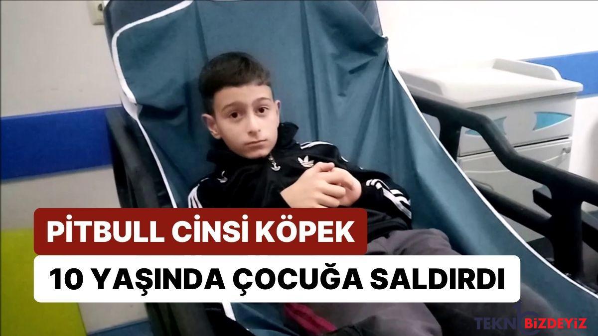 sokakta yuruyen 10 yasindaki cocuga pitbull cinsi kopek saldirdi 2tRaGzqs