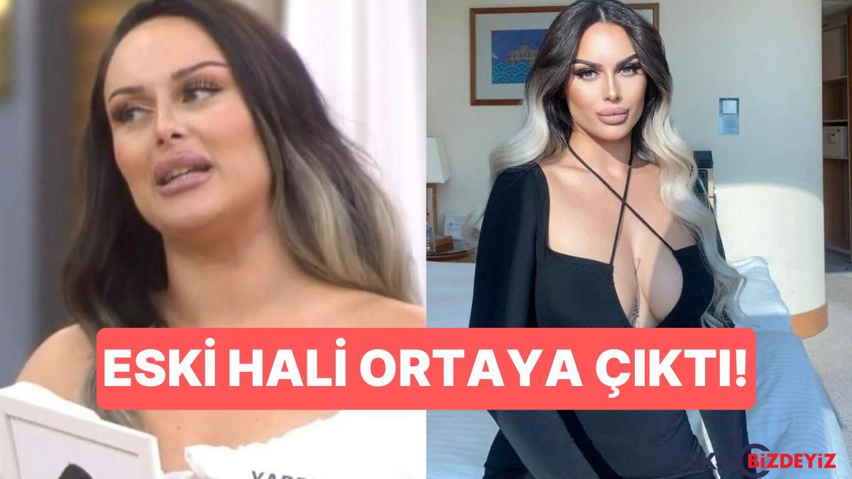 kismetse olurun gelin adayi yaren dagin estetiksiz eski hali ortaya cikti GSHCS9Hv